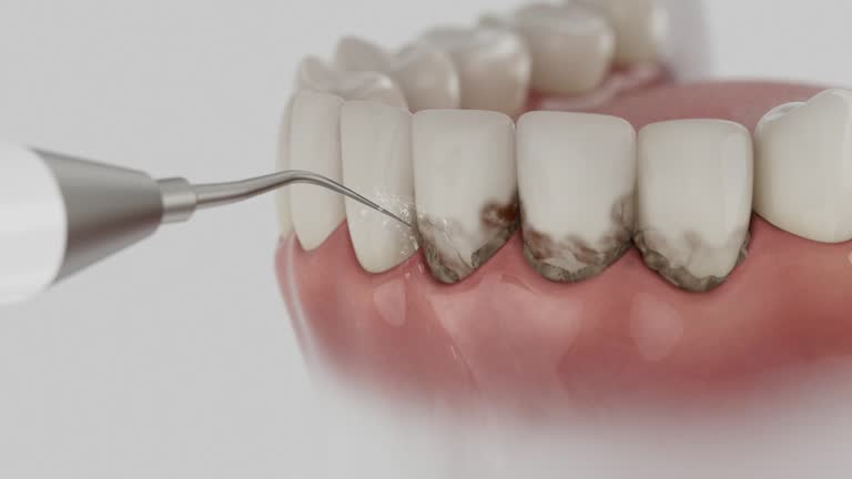 Reliable Teeth Whitening contractor in Ector County County, TX by Dentist Open Now